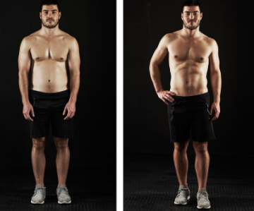 emsculpt mucle builidng