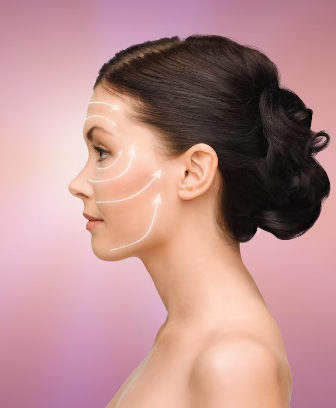 Skin Tightening with Forma