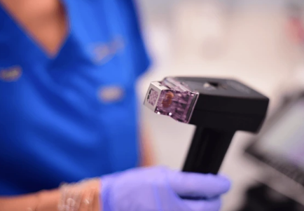 Morpheus8 exosomes skin renewal