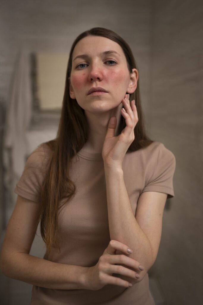 Acne and acne scar treatment in Dubai at Elite Style Polyclinic